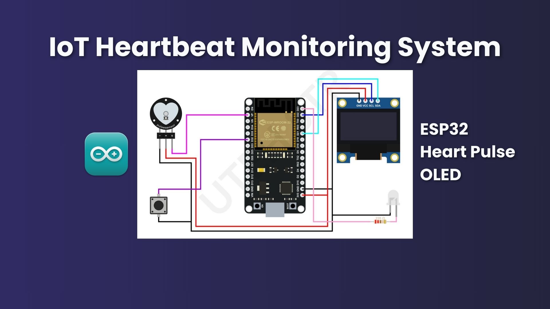 IoT Heartbeat Monitoring System